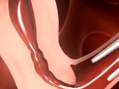 在上海治疗女性不孕不育价格是多少