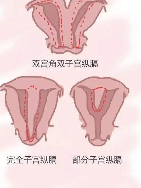 曲靖男科医院排top10，2026费用多少、地址这都有