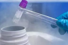 去美国做试管婴儿是否需做羊水穿刺及其优势解析