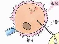 人工试管双胎多少钱？附试管生双胎价目表！